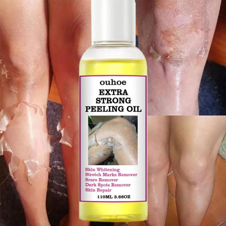 Yellow Peeling Oil 110ml Super Strength Dead Skin Remover